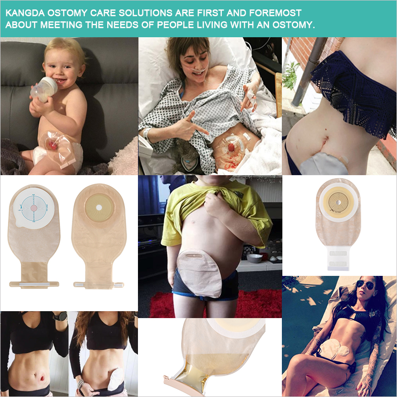 One piece drainable colostomy pouch